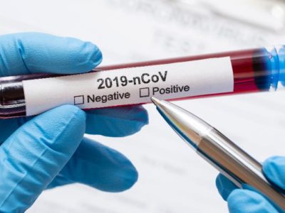 Garça confirma o segundo caso de  coronavírus