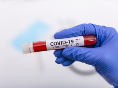 Marília registra nova morte por coronavírus e tem mais de mil testes positivos