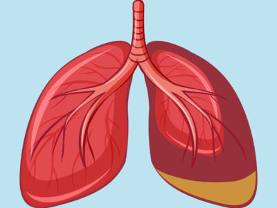 Sistema respiratório: futuros médicos e uma abordagem necessária