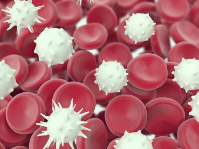 Estudo brasileiro cria composto menos agressivo para o tratamento de leucemia linfoide aguda