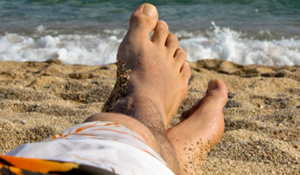 Micose de praia: tratamento deve durar um mês, mas poucos seguem orientação; veja como se prevenir