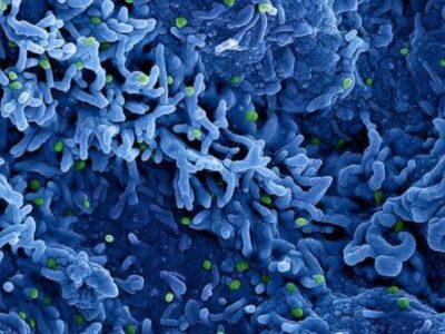 Varíola símia: conheça a vacina em negociação pelo Ministério da Saúde