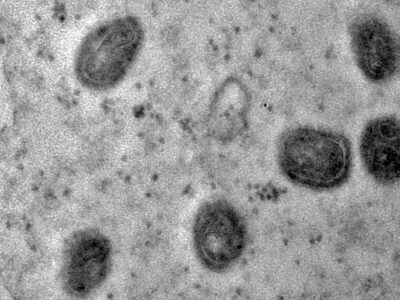 Fiocruz isola o vírus monkeypox e registra em imagens sua estrutura detalhada; VEJA A IMAGEM
