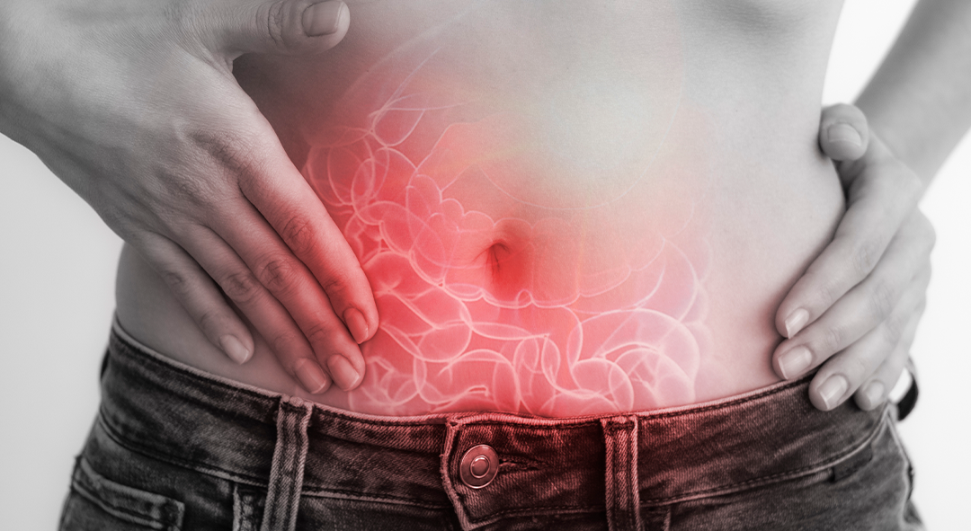 Câncer no intestino: diagnóstico e tratamento precoce tem chance de cura superior a 90% dos casos