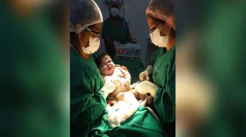 Bebê “gigante” de 7,3 kg nasce no Amazonas. Confira!