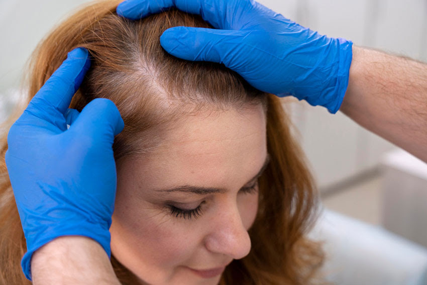 Cliente com queda de cabelo, como ajudar? Nossos fios sofrem mais agressões durante as estações mais frias. Veja dicas