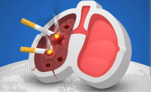 Sucesso: 70% das pessoas que iniciaram tratamento no Ambulatório de Tabagismo da Santa Casa de Marília largaram o vício