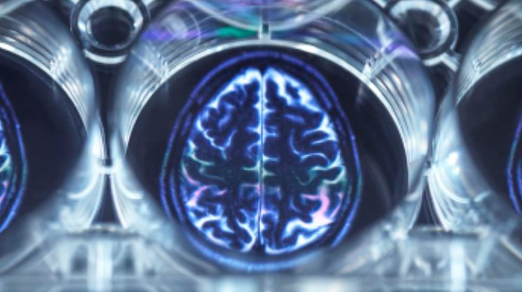 Implantado chip no cérebro de pacientes e tirados após 15 minutos. Cirurgia de remoção tumor no cérebro contribuiu com os testes práticos para o aperfeiçoamento da tecnologia