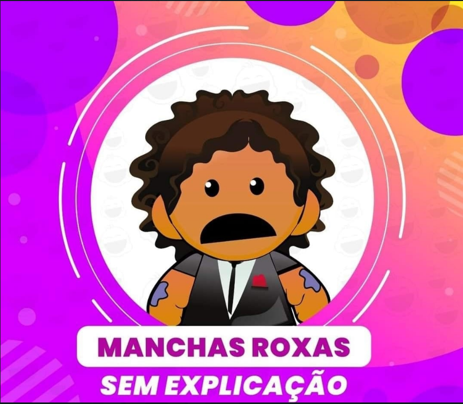 Você tem manchas roxas pelo corpo e não sabe nem como surgiram?