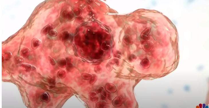 Criança morre após contrair ameba comedora de cérebro