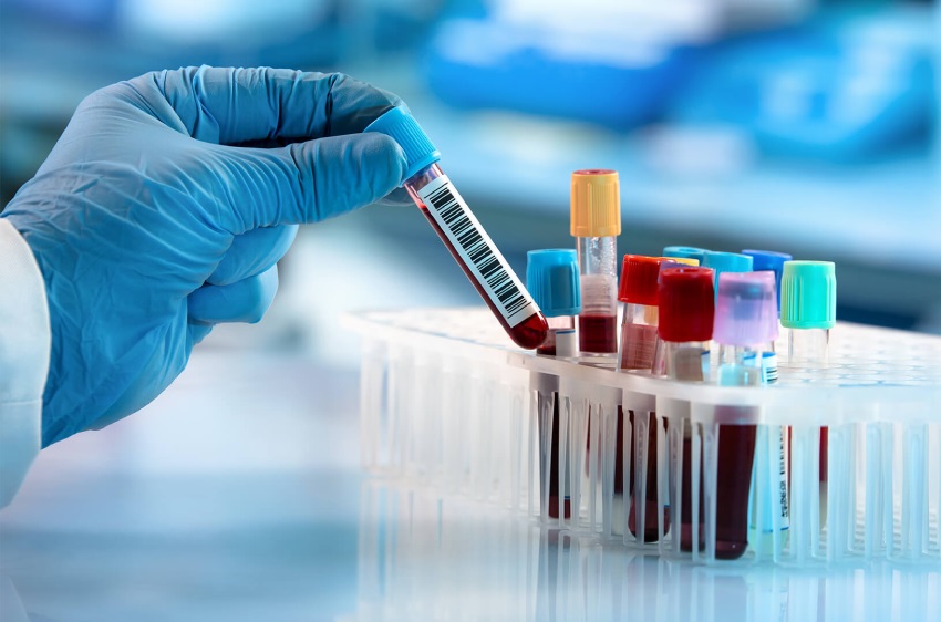 Medida da Anvisa proíbe paciente de escolher laboratório para diagnóstico de doenças como o câncer