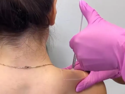 ‘Barbie Botox’: uso da substância para imitar pescoço da boneca viraliza nas redes; VEJA PROCEDIMENTO