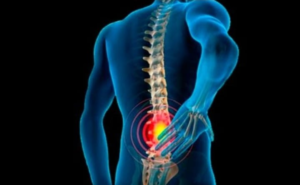 Entenda melhor o que causa e como evitar a dor no nervo ciático. Médico explica causa da “ciatalgia” e traz soluções