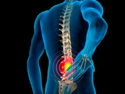Entenda melhor o que causa e como evitar a dor no nervo ciático. Médico explica causa da “ciatalgia” e traz soluções