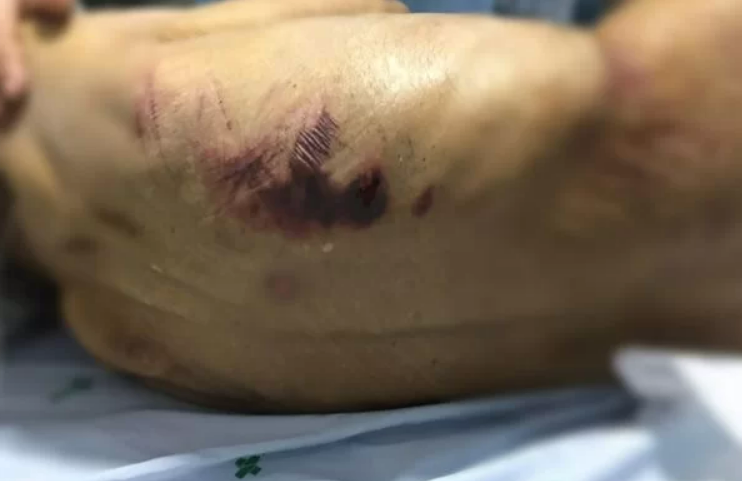 Polícia resgata 50 vítimas de cárcere e tortura em clínica clandestina