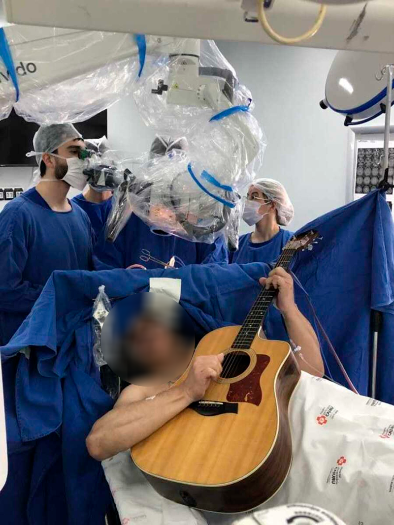 Impressionante: Paciente canta e toca violão durante cirurgia para retirar tumor cerebral;