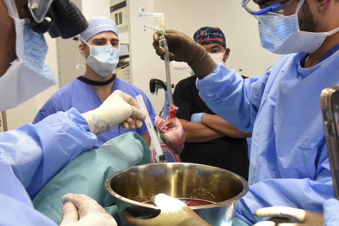 Segundo transplante com coração de porco para humano é feito com sucesso