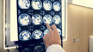 Por que o cérebro humano é tão grande em relação ao de outras espécies?