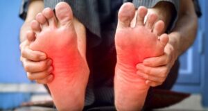 Colesterol alto: sinais podem aparecer nos pés. Veja quais!