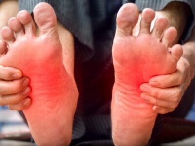 Colesterol alto: sinais podem aparecer nos pés. Veja quais!