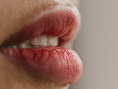Lábios ressecados podem significar mais que desidratação e pode estar ligado a doenças sérias; Saiba mais
