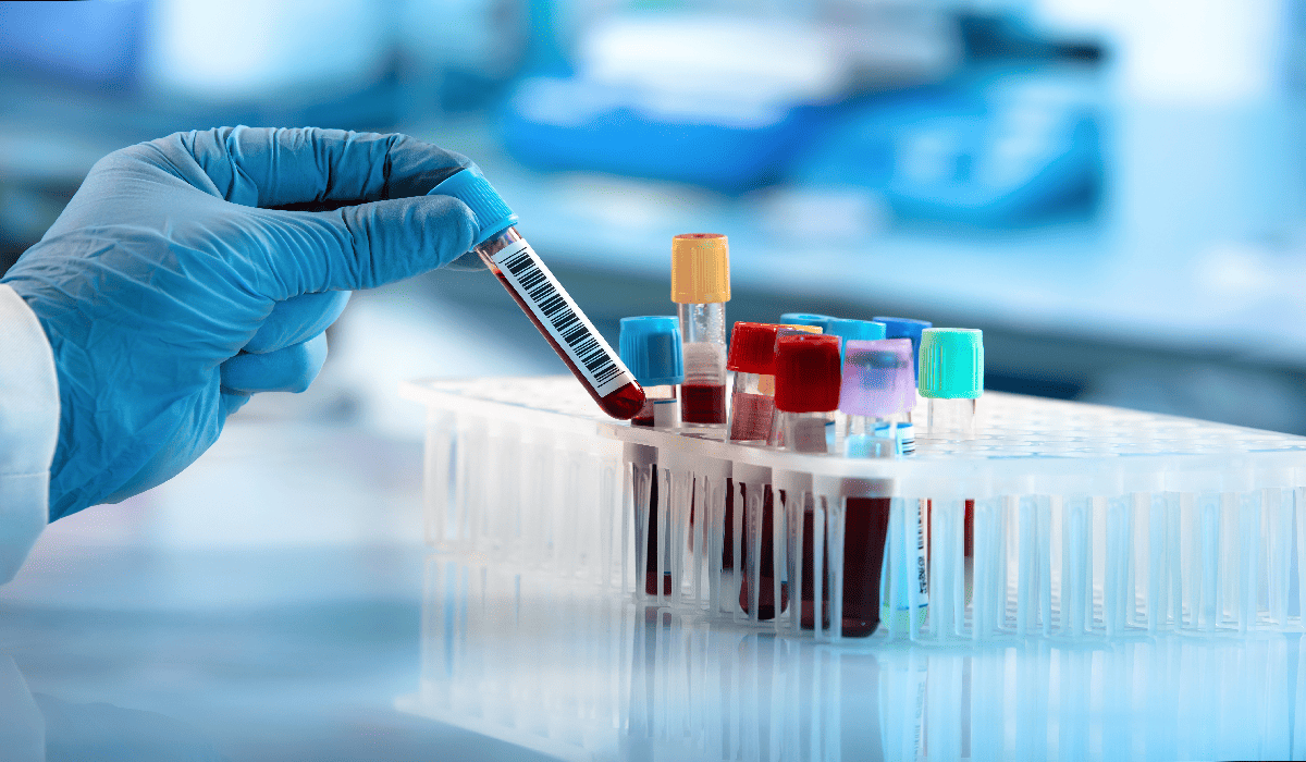 Teste sanguíneo pode diagnosticar bipolaridade, diz estudo