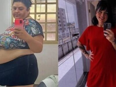 Mulher que pesava 171 kg muda hábitos, emagrece 70 kg e impressiona a web ao mostrar antes e depois do rosto;