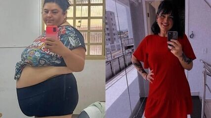 Mulher que pesava 171 kg muda hábitos, emagrece 70 kg e impressiona a web ao mostrar antes e depois do rosto;