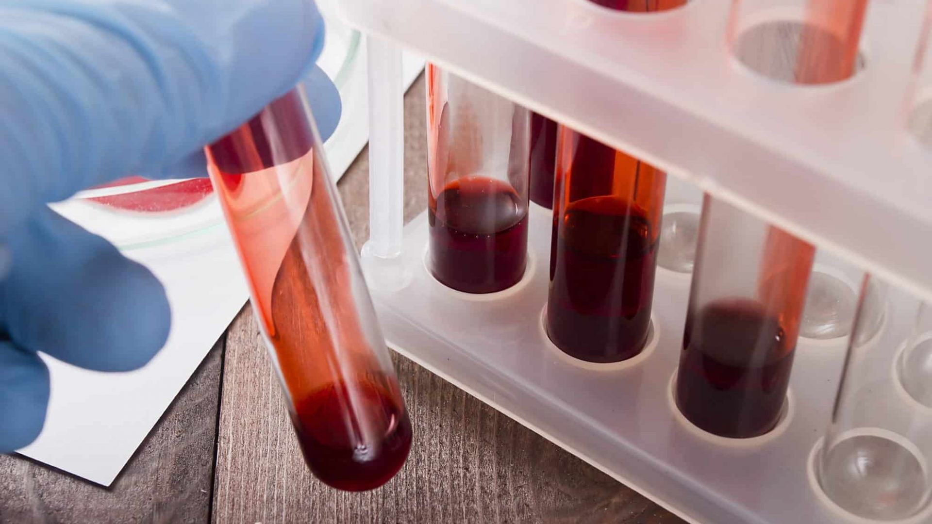 Pesquisadores criam exame de sangue que detecta câncer em até duas horas