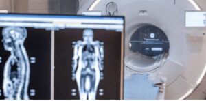 Exame preventivo que detecta câncer custa R$ 12 mil e já tem filas nos EUA