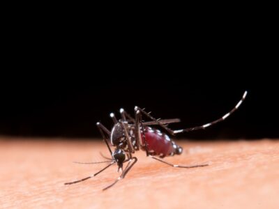 Microcefalia: vírus Zika não é a única causa, alerta campanha
