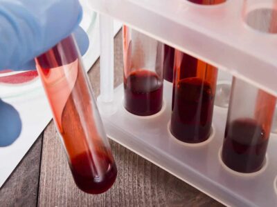 Idade real dos órgãos é revelada através de novo exame de sangue