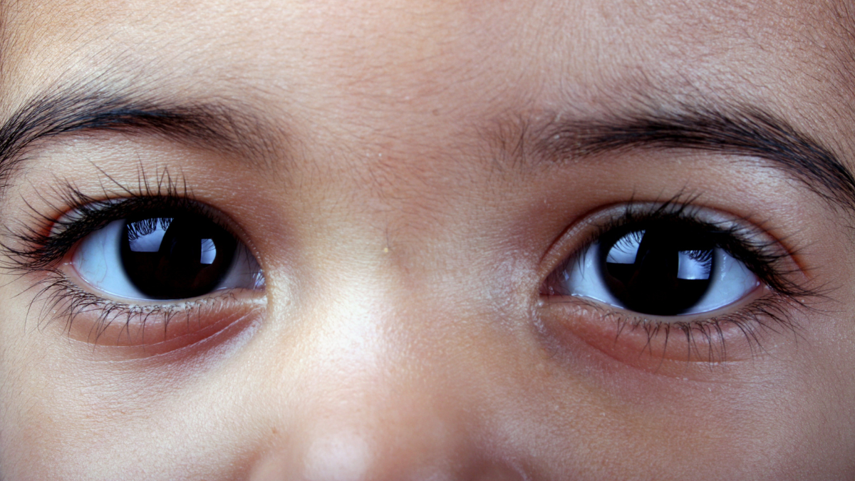 Exame de retina feito por IA identifica autismo em crianças