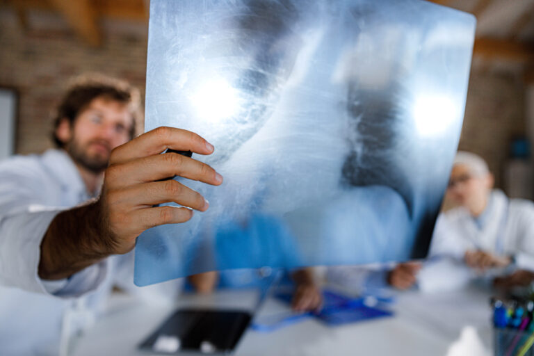 Pneumonia do ‘pulmão branco’ se espalha após surto semelhante na China; ENTENDA