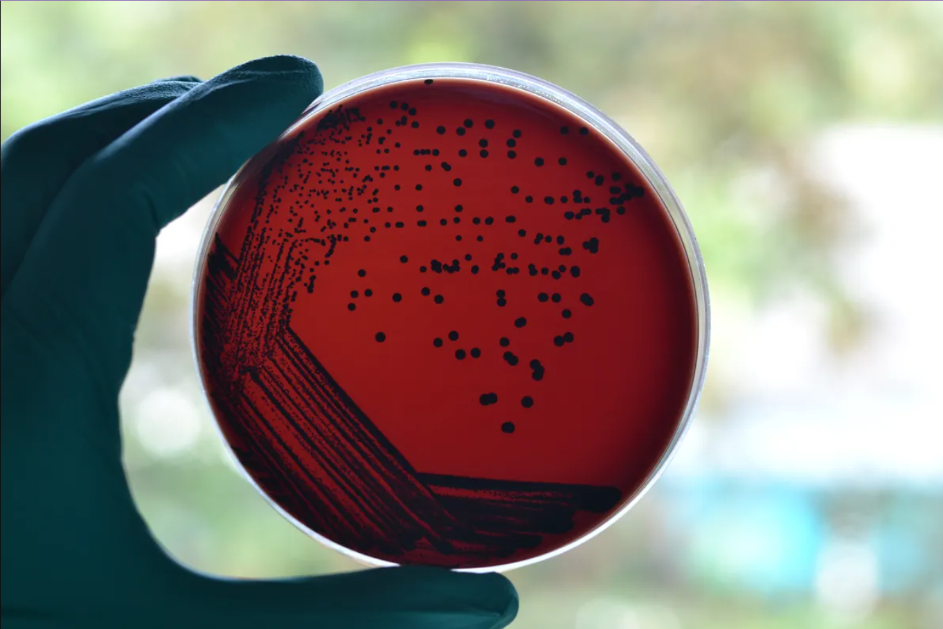 Alerta! 35 novas espécies de bactérias foram identificadas em amostras humanas 