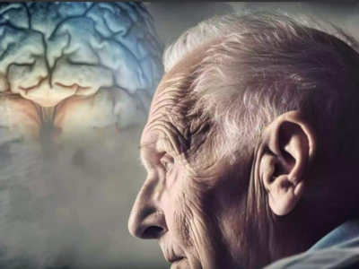 Conheça os dois sinais que podem indicar doença de Alzheimer