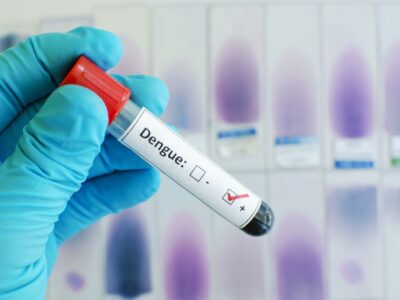 Covid-19 e dengue: como diferenciar os sintomas?