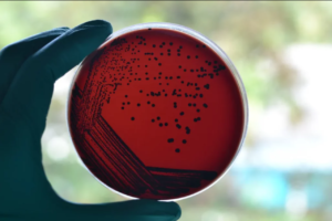 Rede em nuvem vai demorar segundos para identificar bactérias