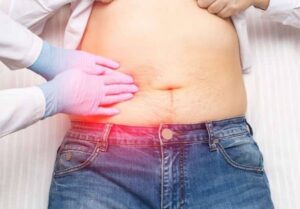 Conheça 6 sintomas que podem indicar pedra na vesícula; saiba o que fazer em caso de suspeita