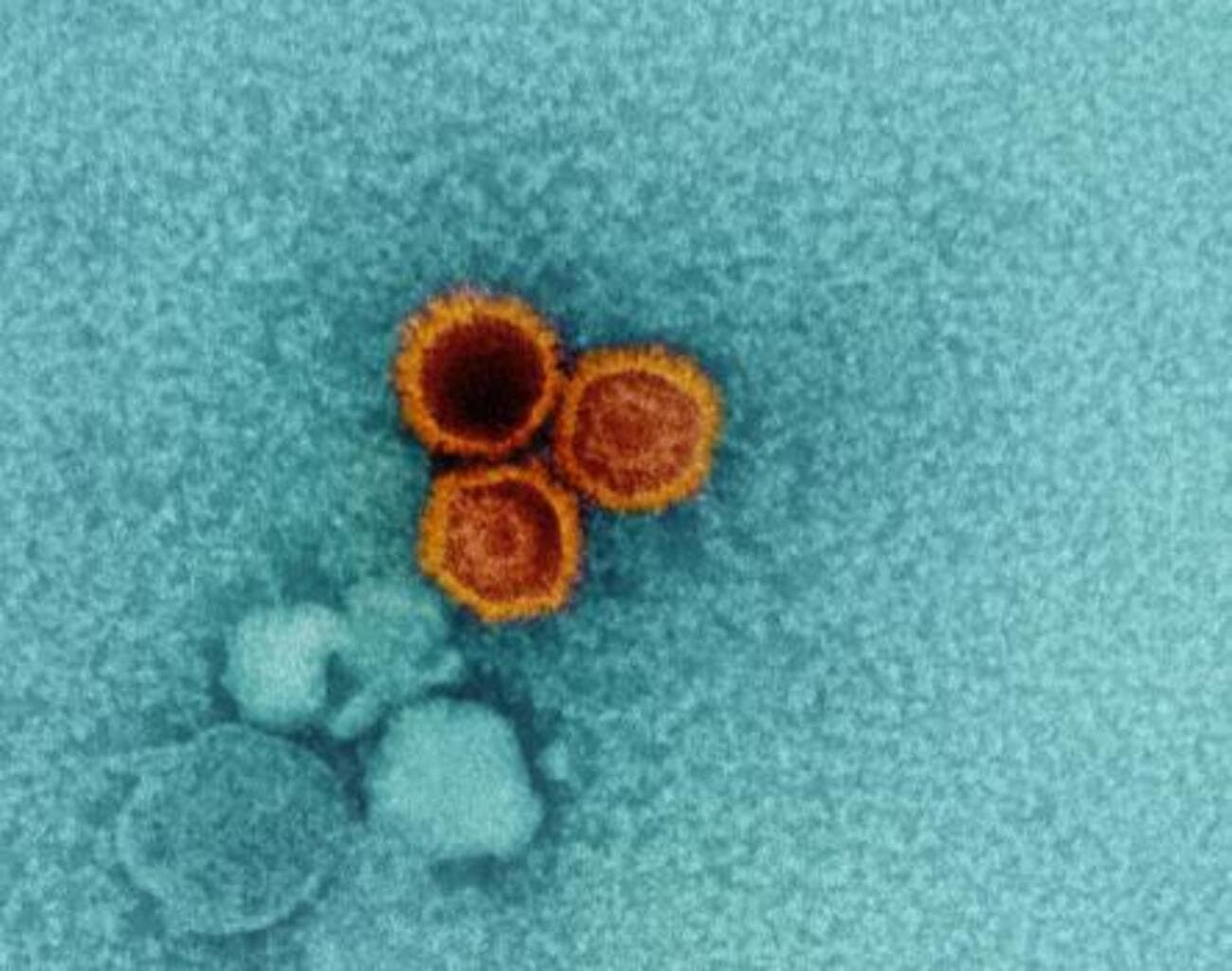 Anticorpo pode ser capaz de combater vírus que infecta 95% da população mundial