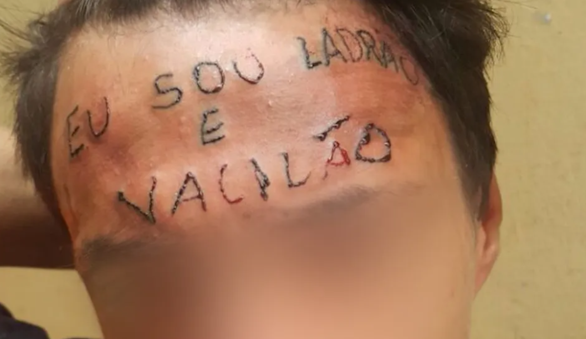 De novo? Jovem que teve testa tatuada com ‘eu sou ladrão e vacilão’ é preso novamente por roubo