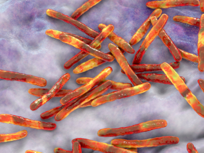 Combate à tuberculose: especialista indica testagem massiva em grupos de risco
