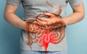 Estudo revela: remédio para dor pode agir como proteção contra câncer colorretal