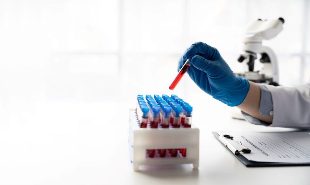 EUA podem aprovar exame de sangue para detectar câncer colorretal