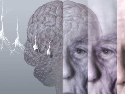 Novas pesquisas avançam na prevenção do Alzheimer: descobertas, como vacina, e perspectivas