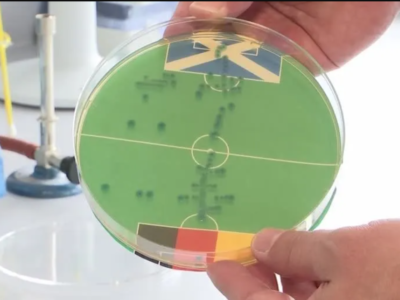 Bactéria faz ‘previsão’ sobre resultados da Eurocopa em laboratório e imagens viralizam; VEJA