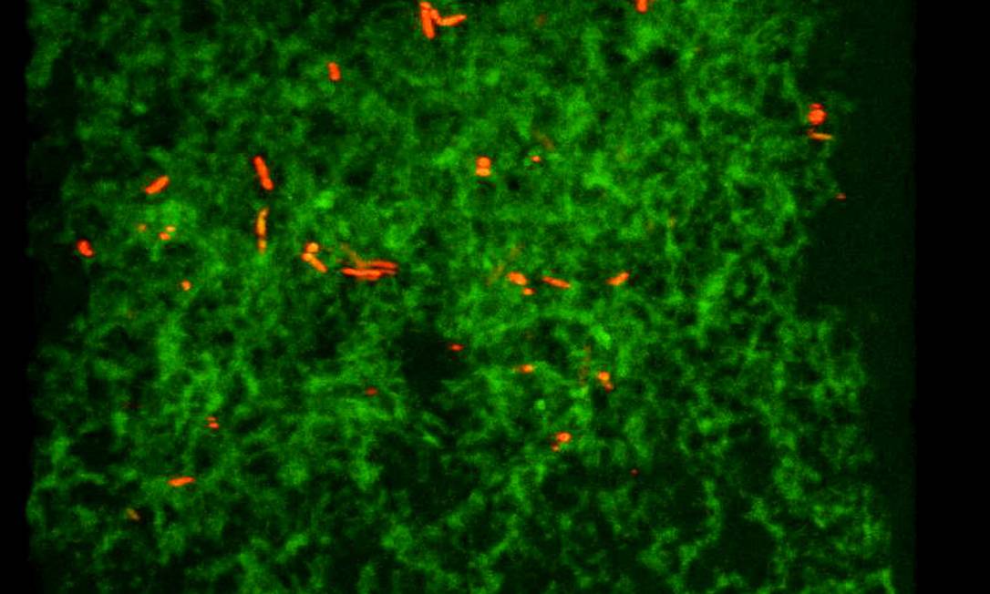 Proteína que provoca Alzheimer é a mesma que protege o cérebro