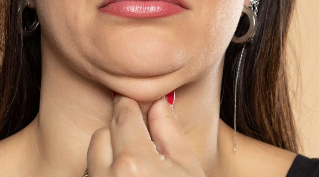 7 maneiras eficazes de acabar com a papada