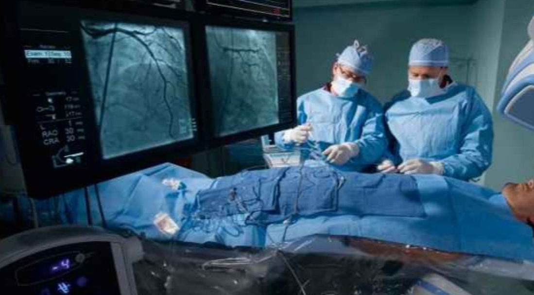 Angioplastia: procedimento contra infarto evolui e entra na era da inteligência artificial