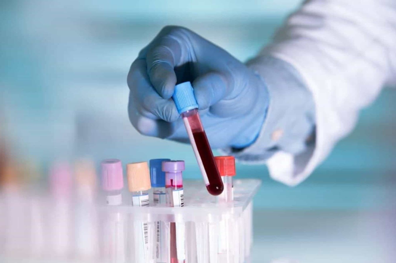 Startup quer cultivar sangue em laboratório. Entenda o motivo